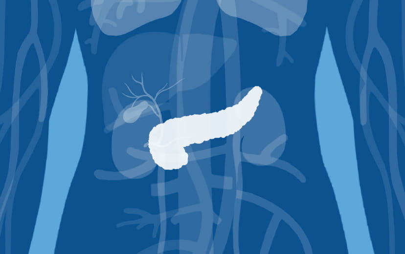 Organ affected: pancreas
