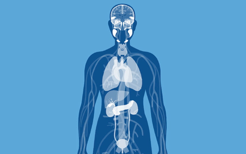 Understanding the disease