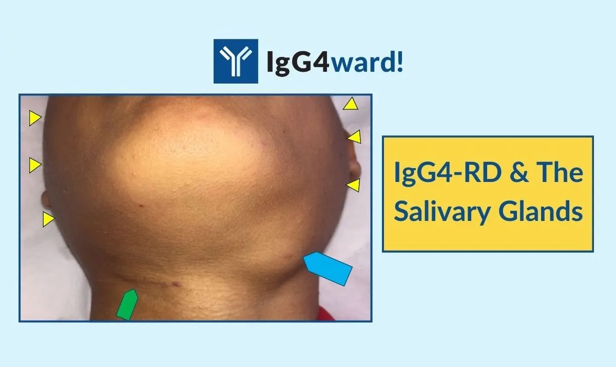 IgG4-RD Question of the Week – IgG4-RD, the salivary glands, other potential organ involvement, and insurance coverage 