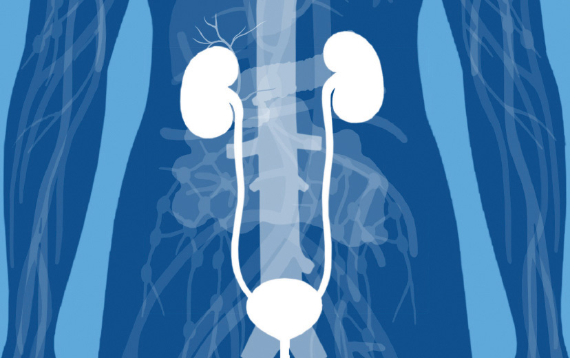 Organ affected: kidneys