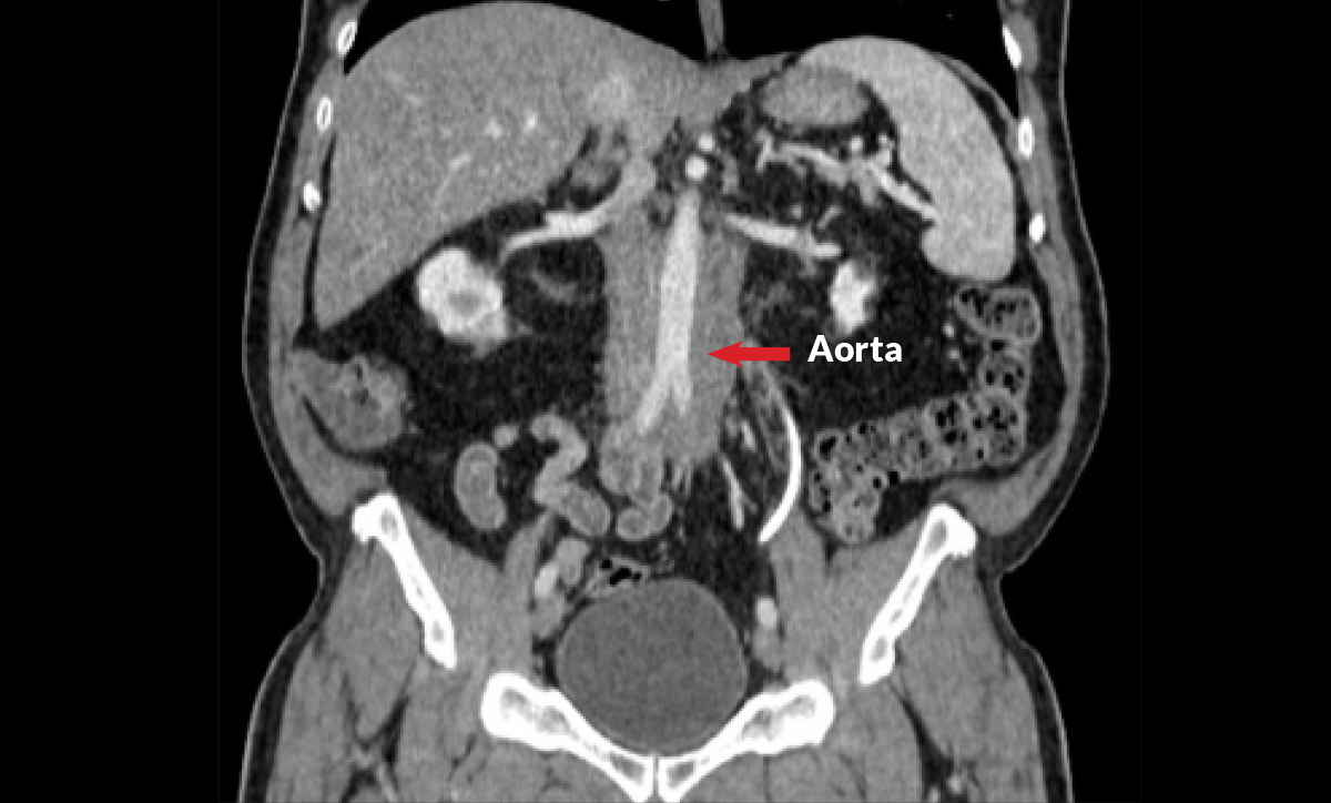 IgG4ward_Academy_Chapter 7_Ln 3_02A_1200x724pxl.jpg (1)