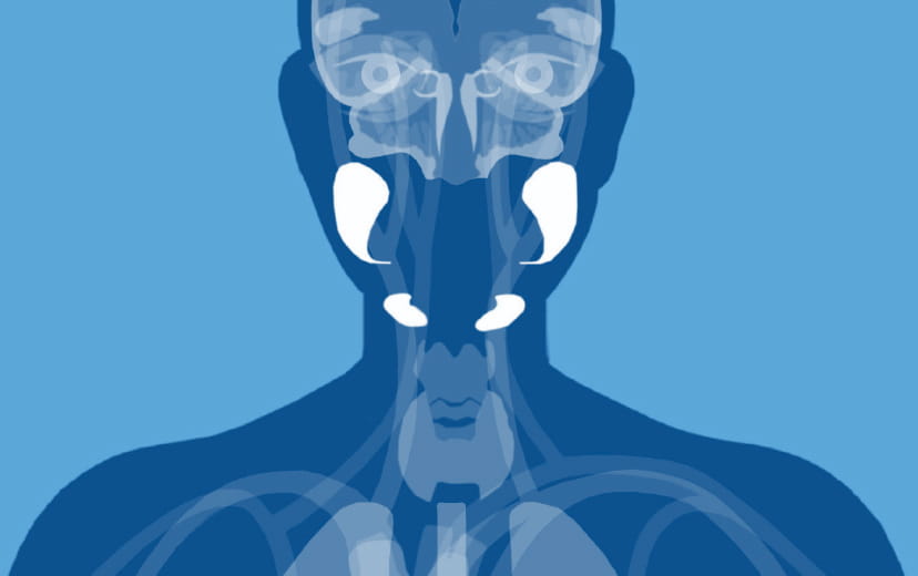 Organ affected: salivary & lacrimal glands